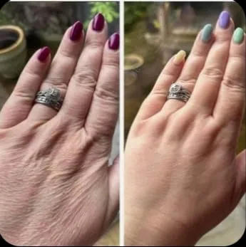 PDNR DNA DE SALMÂO - Foto 3